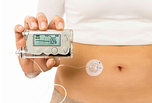 直流无刷电机 胰岛素泵能简化糖尿病患者的生活