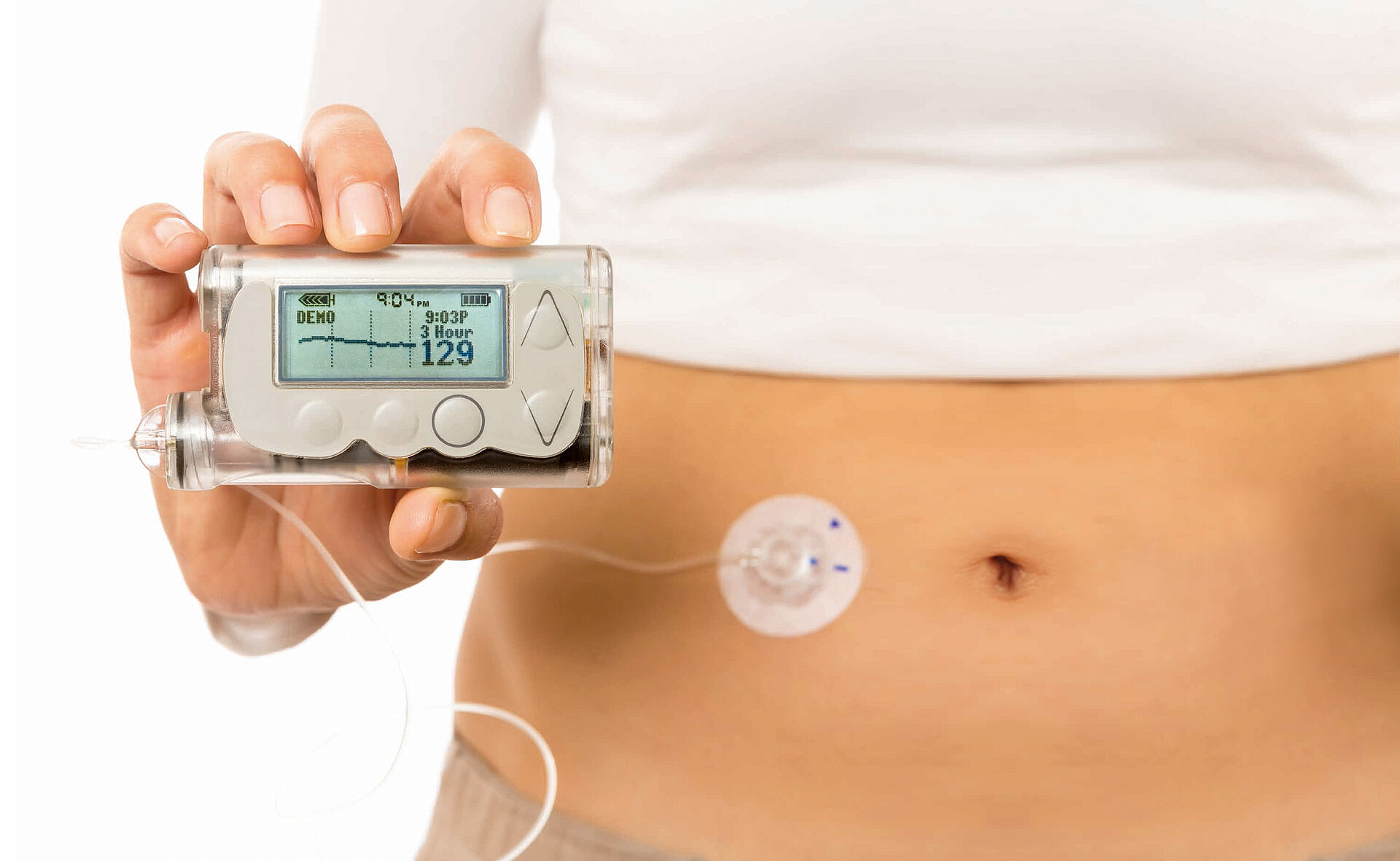 直流无刷电机 胰岛素泵能简化糖尿病患者的生活