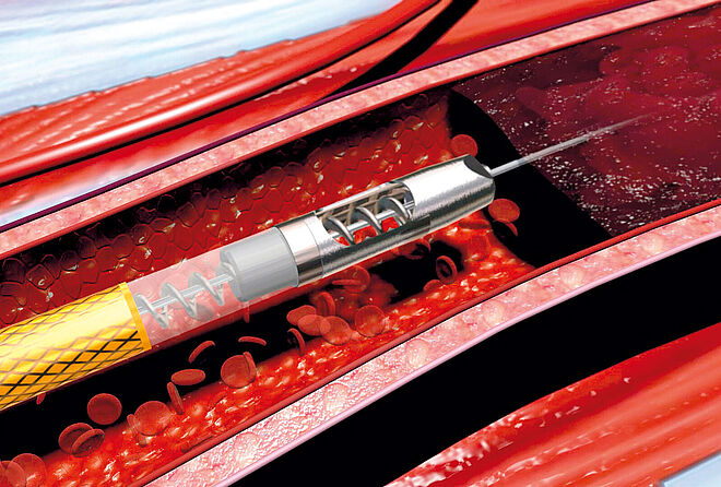 直流无刷电机 在医用导管中, header 直流无刷电机 用于医疗仪器导管